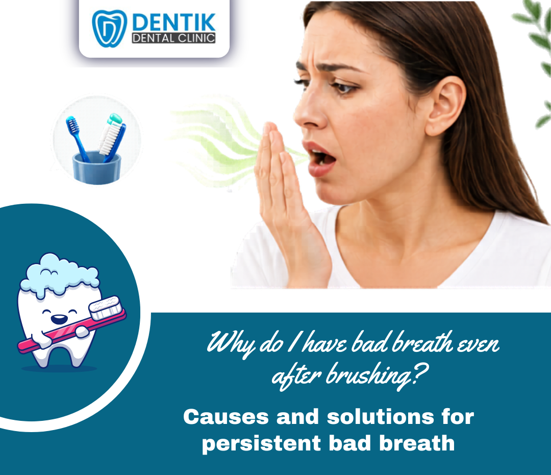 Blog-1-dentik