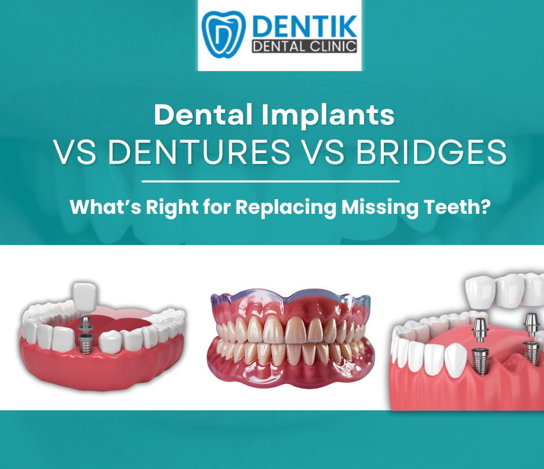 Dental Implants vs Dentures vs Bridges What’s Right for Replacing Missing Teeth